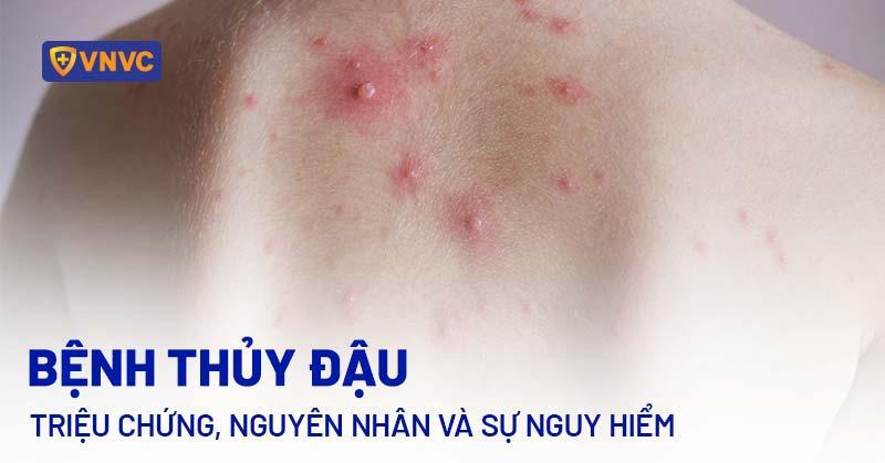 Hình ảnh dây điện đồng bị quá nhiệt và dấu hiệu nguy hiểm cần chú ý trong hệ thống điện