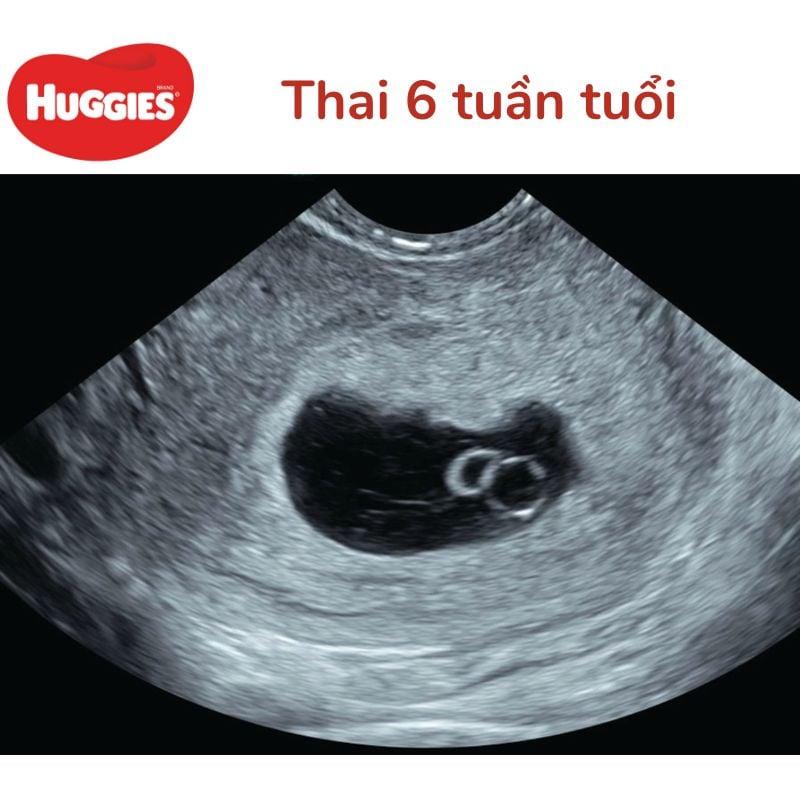 Hình ảnh biểu tượng cho việc lập kế hoạch 9 tháng, giúp hiểu rõ thời gian và các mốc cần lưu ý.